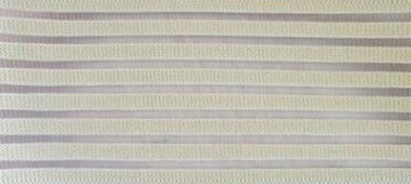  影響?hù)~(yú)絲帶質(zhì)量的原因是啥？